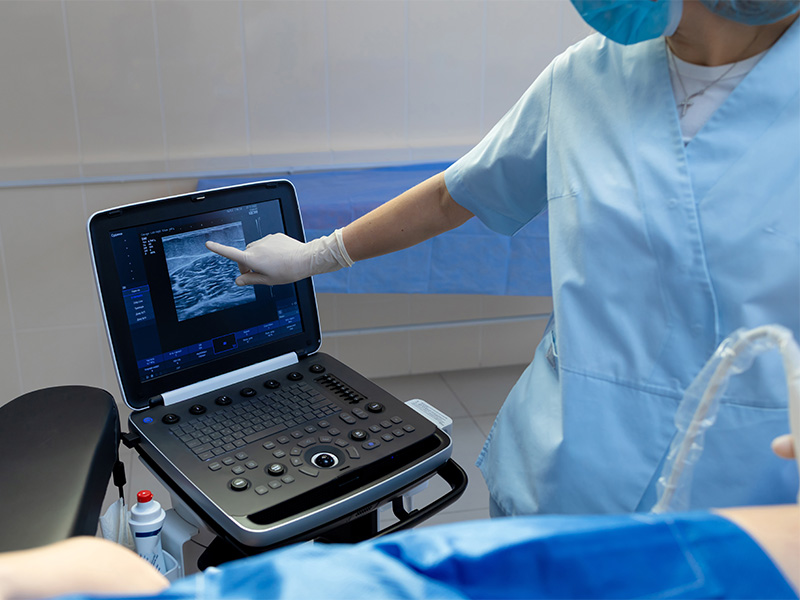 Duplexsonografie bei Venenerkrankungen an Füßen einer älteren Frau, Untersuchung und Beratung in Hofheim.